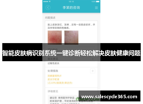 智能皮肤病识别系统一键诊断轻松解决皮肤健康问题