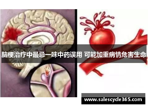 脑梗治疗中最忌一味中药误用 可能加重病情危害生命